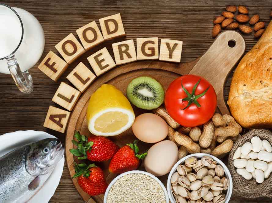 FOOD ALLERGY