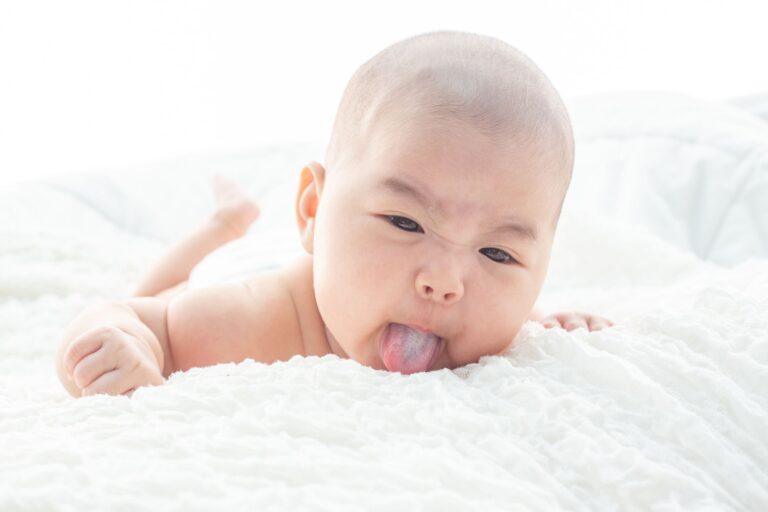 Curdled Milk on a Baby’s Tongue